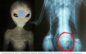 Name:  alien probe.jpg
Views: 176
Size:  14.0 KB