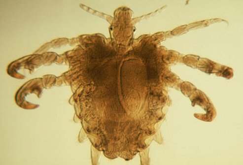 Name:  stds-s2-photo-of-pubic-lice.jpg
Views: 356
Size:  25.1 KB
